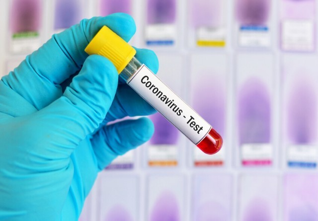 Apteklərdə satılan koronavirus testləri nə dərəcədə etibarlıdır?