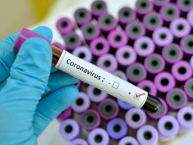 Koronavirusa yoluxanların sayı 1 000 000-u ötdü
